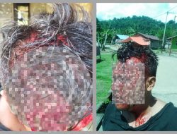 2 Anggota Polisi jadi Korban Pengeroyokan di Desa Yaba Halsel